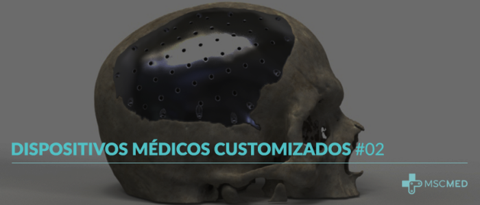 Dispositivos Médicos Customizados #02